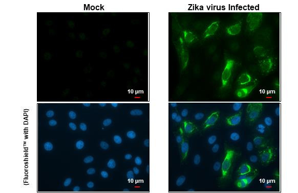 Zika Virus prM (strain H/PF/2013) Antibody in Immunocytochemistry (ICC/IF)