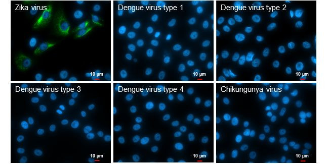 Zika Virus NS4A (strain H/PF/2013) Antibody in Immunocytochemistry (ICC/IF)