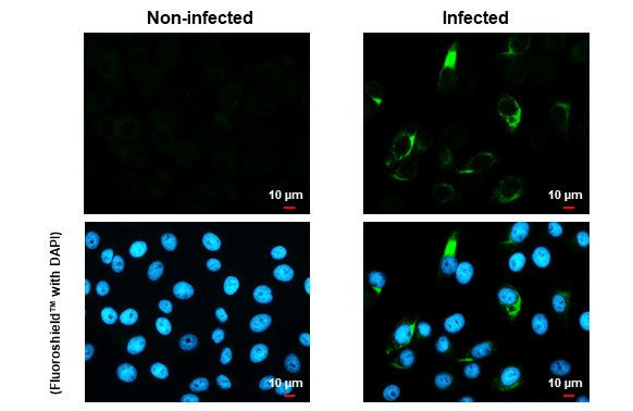 Zika Virus NS4A (strain H/PF/2013) Antibody in Immunocytochemistry (ICC/IF)