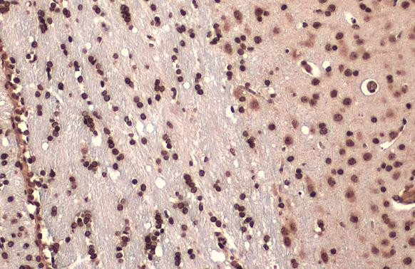 FOXP2 Antibody in Immunohistochemistry (Paraffin) (IHC (P))