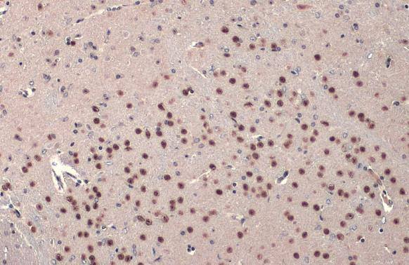 FOXP2 Antibody in Immunohistochemistry (Paraffin) (IHC (P))