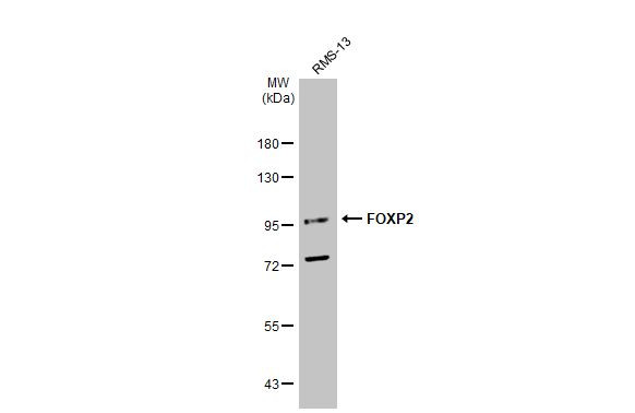 FOXP2 Antibody in Western Blot (WB)