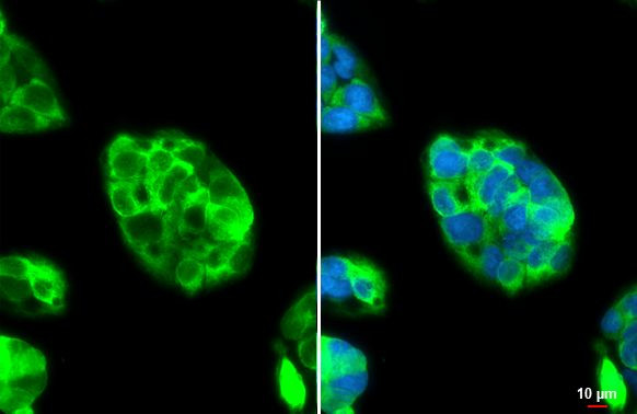 Fibrinogen Antibody in Immunocytochemistry (ICC/IF)