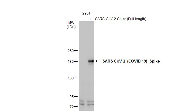 SARS-CoV-2 Spike Protein S2/S2' (strain Wuhan-Hu-1) Antibody in Western Blot (WB)