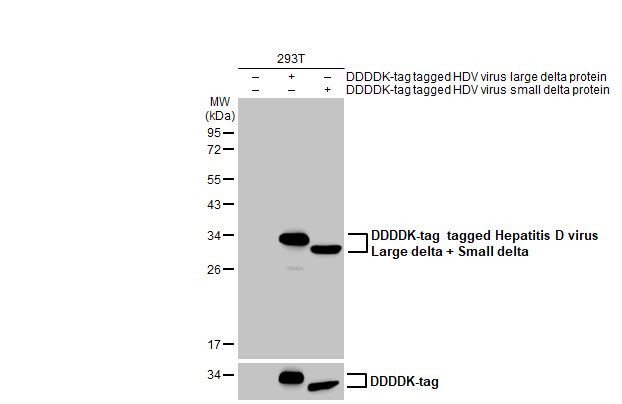 Hepatitis D virus Antibody in Western Blot (WB)