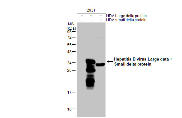 Hepatitis D virus Antibody in Western Blot (WB)