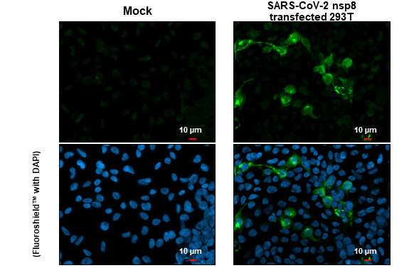 SARS-CoV-2 NSP8 Antibody in Immunocytochemistry (ICC/IF)