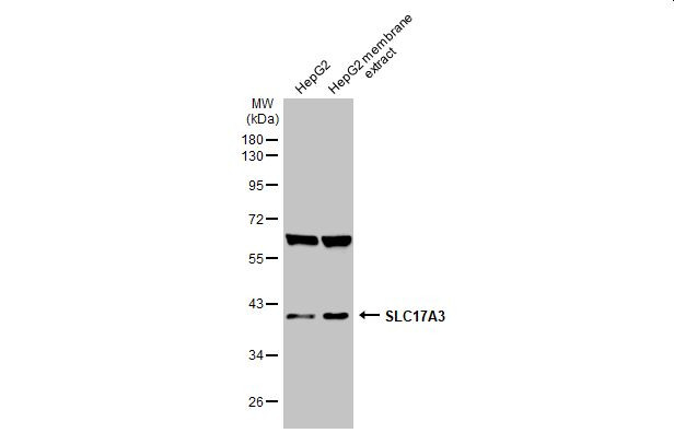 SLC17A3 Antibody in Western Blot (WB)