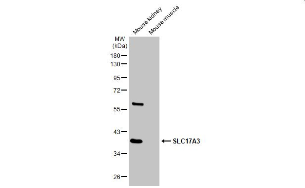 SLC17A3 Antibody in Western Blot (WB)