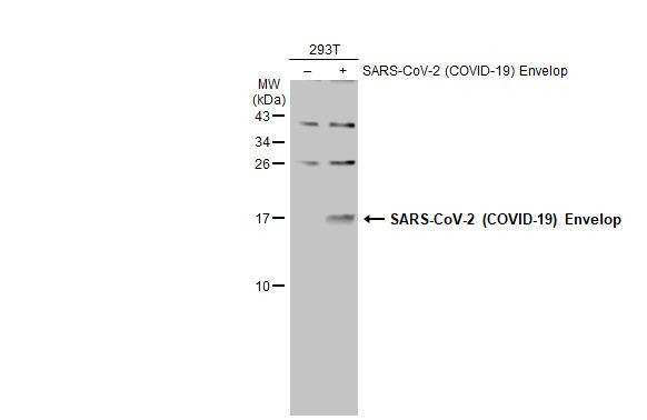 SARS-CoV-2 Envelope Antibody in Western Blot (WB)