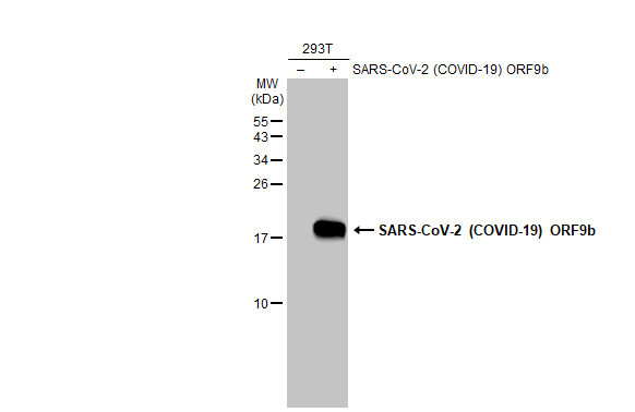 SARS-CoV-2 ORF9b Antibody in Western Blot (WB)