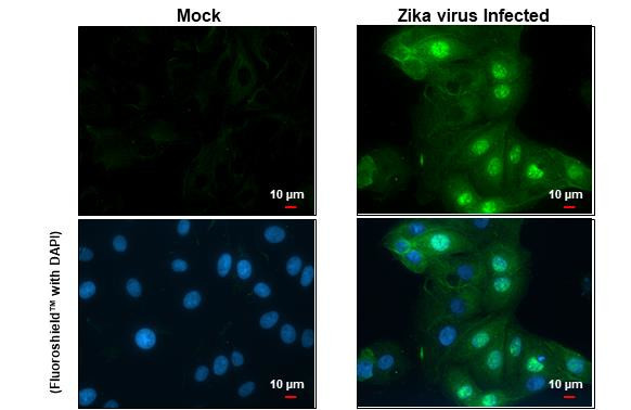 Zika Virus NS5 (strain H/PF/2013) Antibody in Immunocytochemistry (ICC/IF)