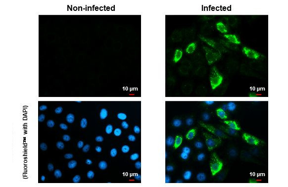 Zika Virus Envelope (strain H/PF/2013) Antibody in Immunocytochemistry (ICC/IF)