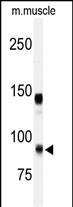 ADAMTS5 Antibody in Western Blot (WB)