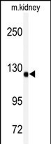 ADAMTS19 Antibody in Western Blot (WB)