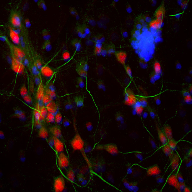 Ankyrin G Antibody in Immunocytochemistry (ICC/IF)