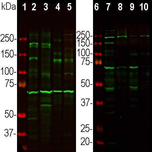 Ankyrin G Antibody in Western Blot (WB)