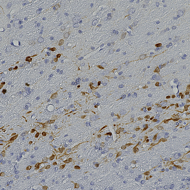 Calretinin Antibody in Immunohistochemistry (Paraffin) (IHC (P))