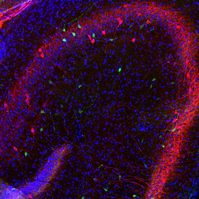 Calretinin Antibody in Immunohistochemistry (PFA fixed) (IHC (PFA))