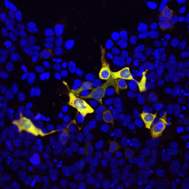 Cas9 Antibody in Immunocytochemistry (ICC/IF)