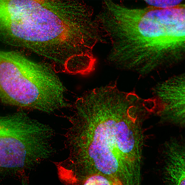 MARCKS Antibody in Immunocytochemistry (ICC/IF)