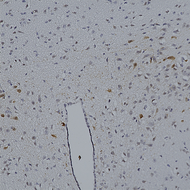 mCherry Antibody in Immunohistochemistry (Paraffin) (IHC (P))