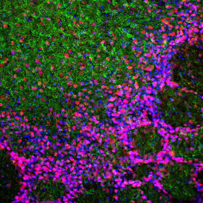 MECP2 Antibody in Immunohistochemistry (PFA fixed) (IHC (PFA))