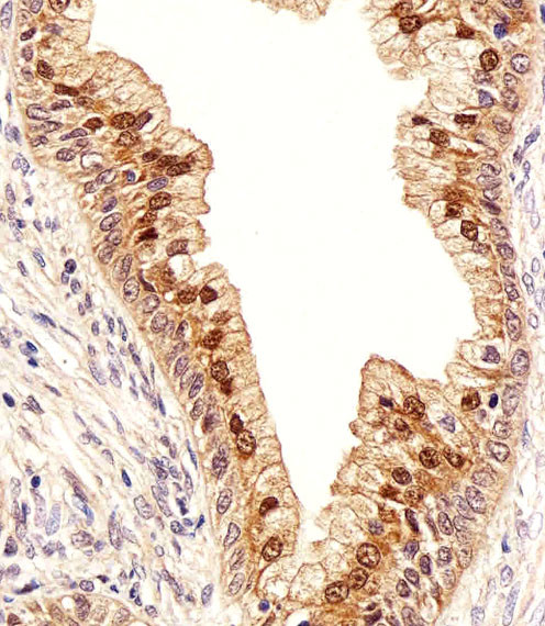 IDH1 Antibody in Immunohistochemistry (Paraffin) (IHC (P))