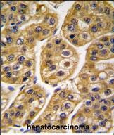 IDH1 Antibody in Immunohistochemistry (Paraffin) (IHC (P))