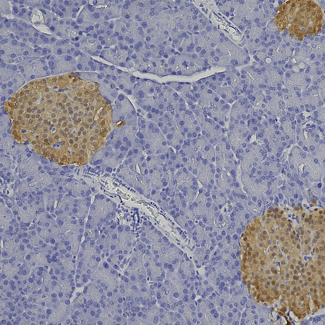 SCGN Antibody in Immunohistochemistry (Paraffin) (IHC (P))