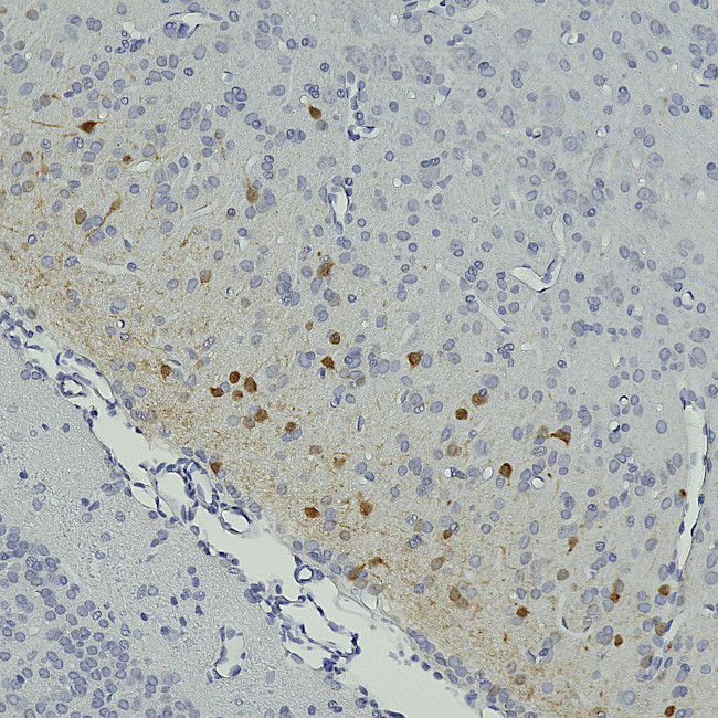 SCGN Antibody in Immunohistochemistry (Paraffin) (IHC (P))