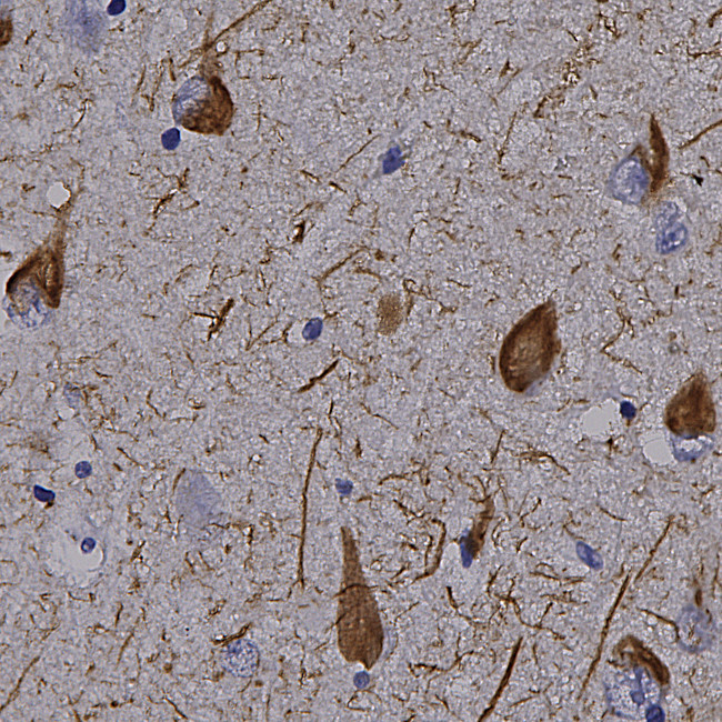 Tau Antibody in Immunohistochemistry (Paraffin) (IHC (P))