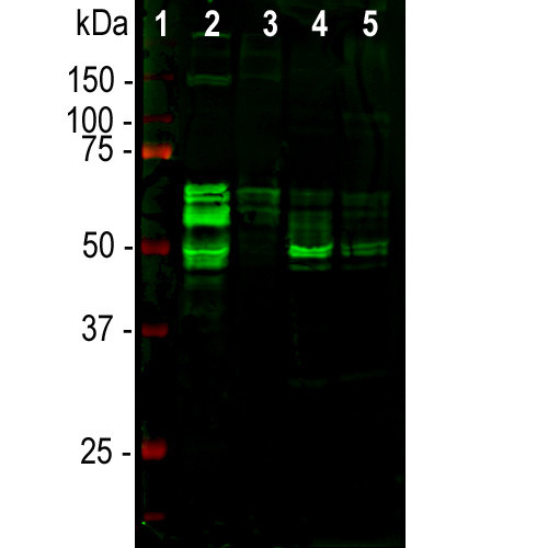 Tau Antibody in Western Blot (WB)