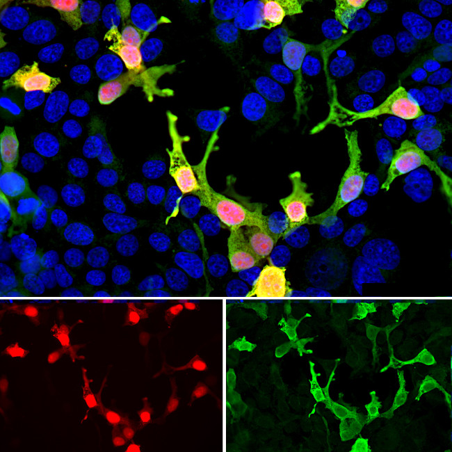 mCherry Antibody in Immunocytochemistry (ICC/IF)