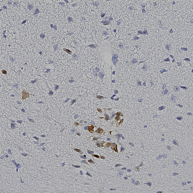 mCherry Antibody in Immunohistochemistry (Paraffin) (IHC (P))