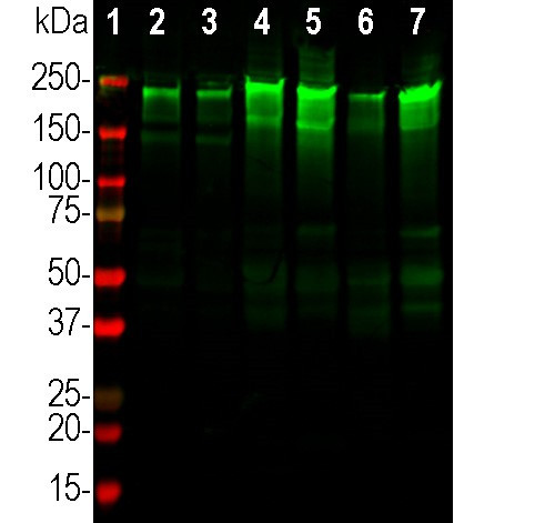 NF-H Antibody in Western Blot (WB)