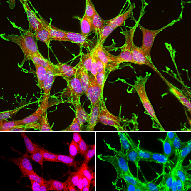 DJ-1 Antibody in Immunocytochemistry (ICC/IF)