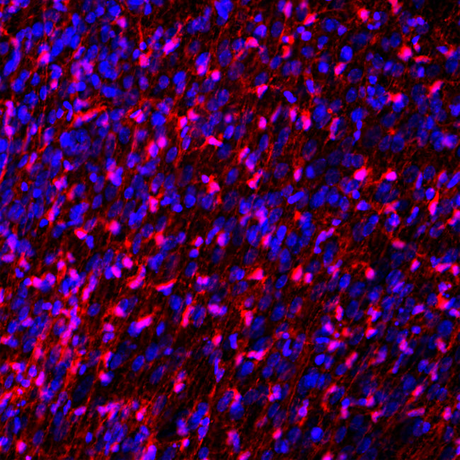 FABP7 Antibody in Immunohistochemistry (IHC)