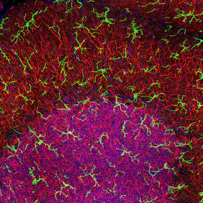 IBA1 Antibody in Immunohistochemistry (Paraffin) (IHC (P))