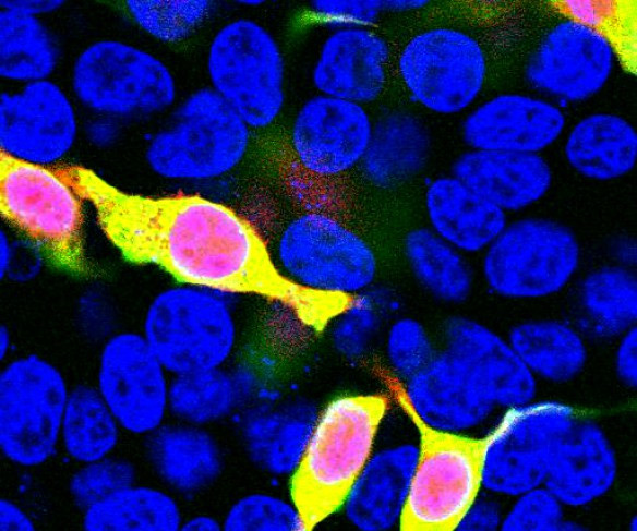 mCherry Antibody in Immunocytochemistry (ICC/IF)