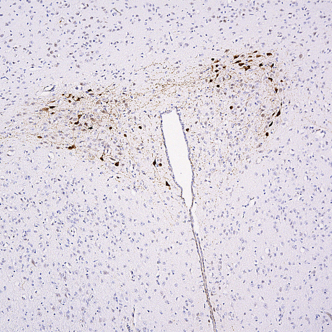 mCherry Antibody in Immunohistochemistry (Paraffin) (IHC (P))