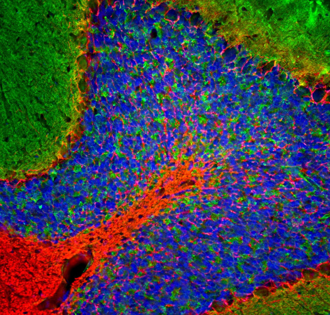 NEFL Antibody in Immunohistochemistry (PFA fixed) (IHC (PFA))