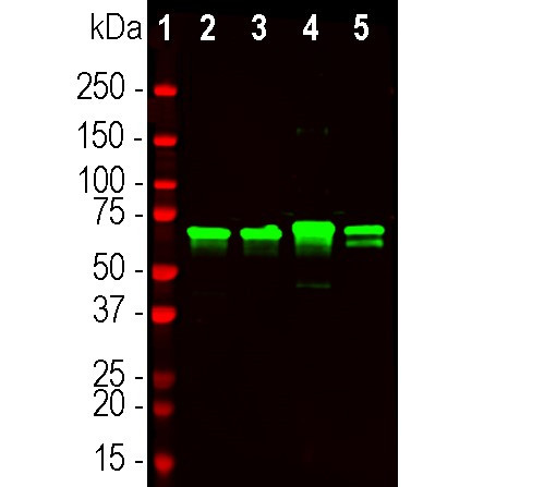 NEFL Antibody in Western Blot (WB)