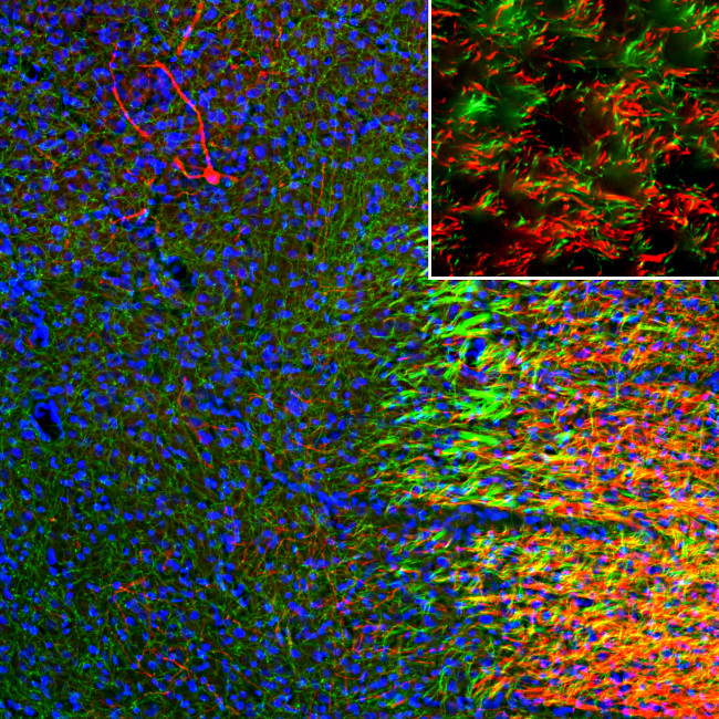 SLC6A4 Antibody in Immunohistochemistry (IHC)