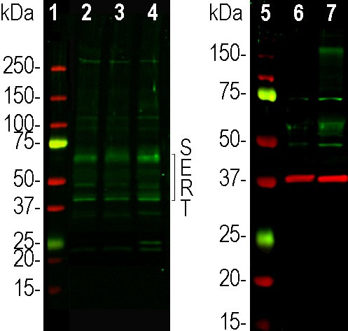 SLC6A4 Antibody in Western Blot (WB)