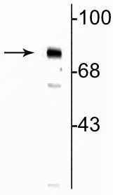 Phospho-MECP2 (Ser80) Antibody in Western Blot (WB)