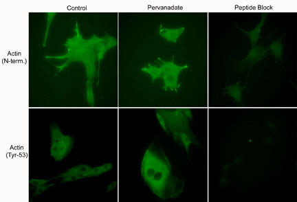 Phospho-Actin (Tyr53) Antibody in Immunocytochemistry (ICC/IF)