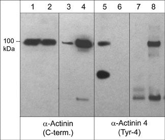 Phospho-alpha Actinin 4 (Tyr4) Antibody in Western Blot (WB)