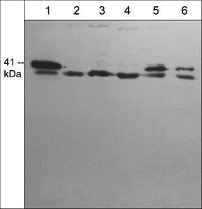 p41-ARCb Antibody in Western Blot (WB)