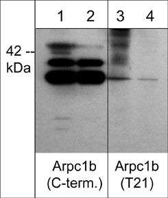 Phospho-p41-ARCb (Thr21) Antibody in Western Blot (WB)